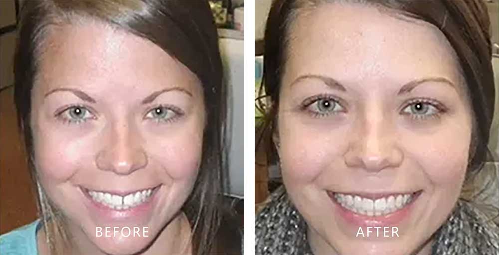 Before After Image 1