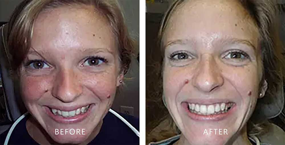 Before After Image 2